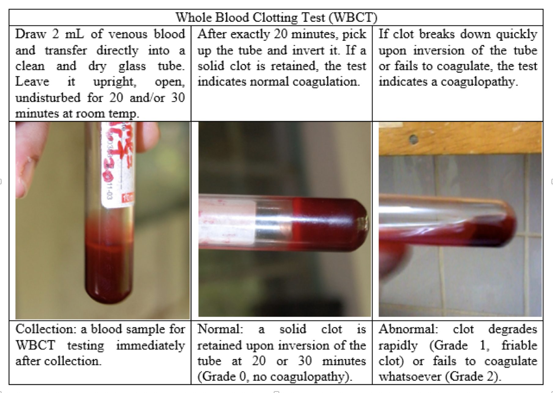 1 रक्त परीक्षण